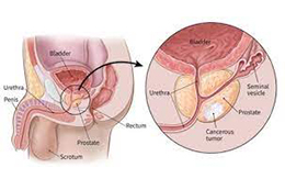 best angioplasty doctor in Kolkata
